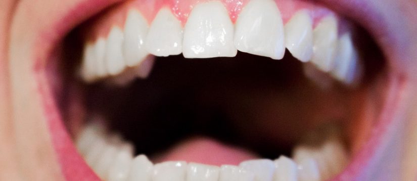 Top Reasons for Professional Teeth Whitening